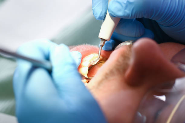 Best Mobile Emergency Dentist in Netcong, NJ