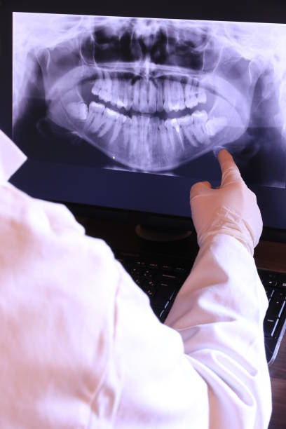 Best Emergency Dentist for Lost Fillings or Crowns in Netcong, NJ