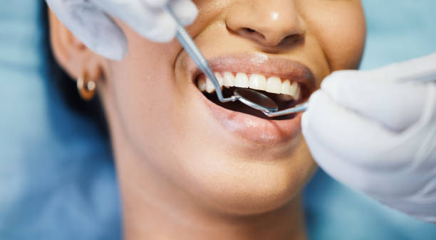 Best Broken or Cracked Tooth Emergency Dentist in Netcong, NJ