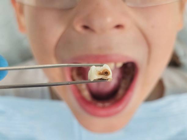 Best Emergency Dentist for Knocked-Out Tooth in Netcong, NJ